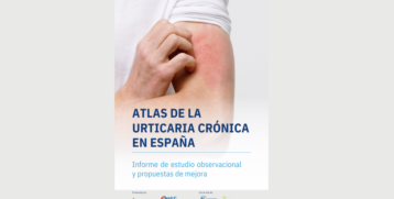 Atlas de urticaria cronica España
