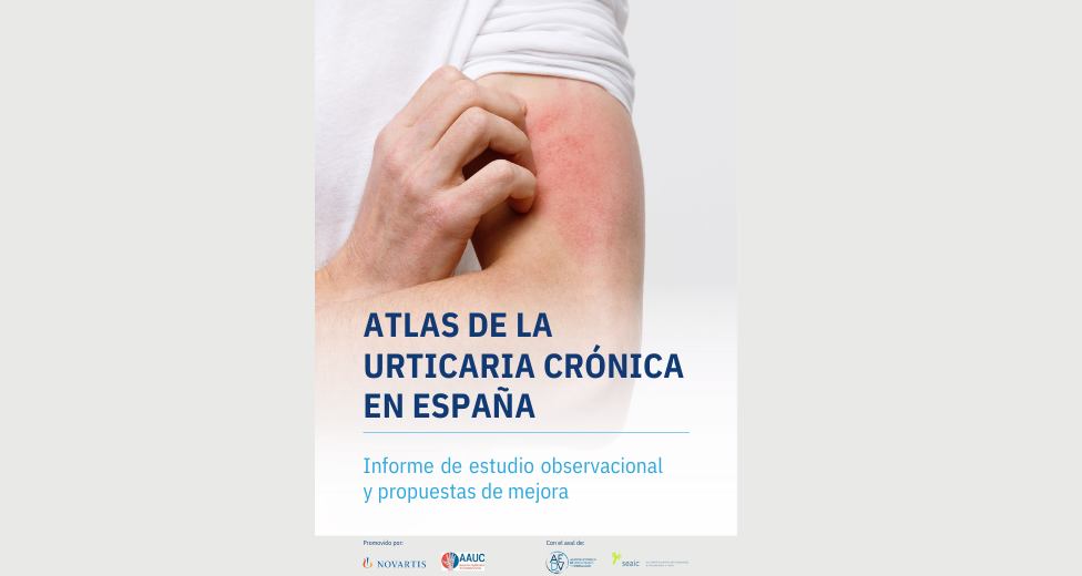 Atlas de urticaria cronica España