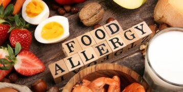 Omalizumab en alergia alimentaria