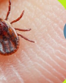 SEAIC garrapatas y sindrome alfa gal