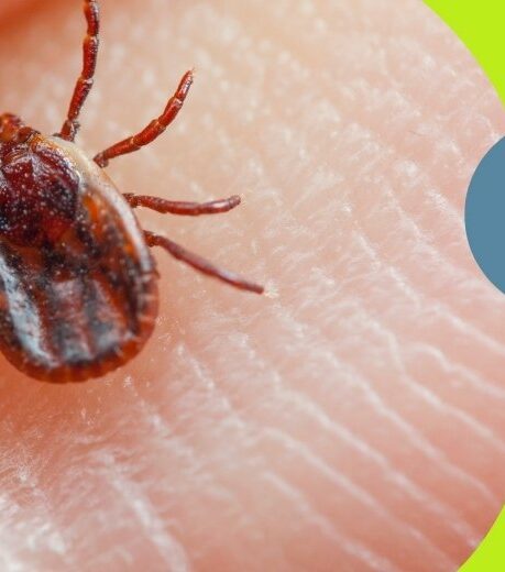 SEAIC garrapatas y sindrome alfa gal